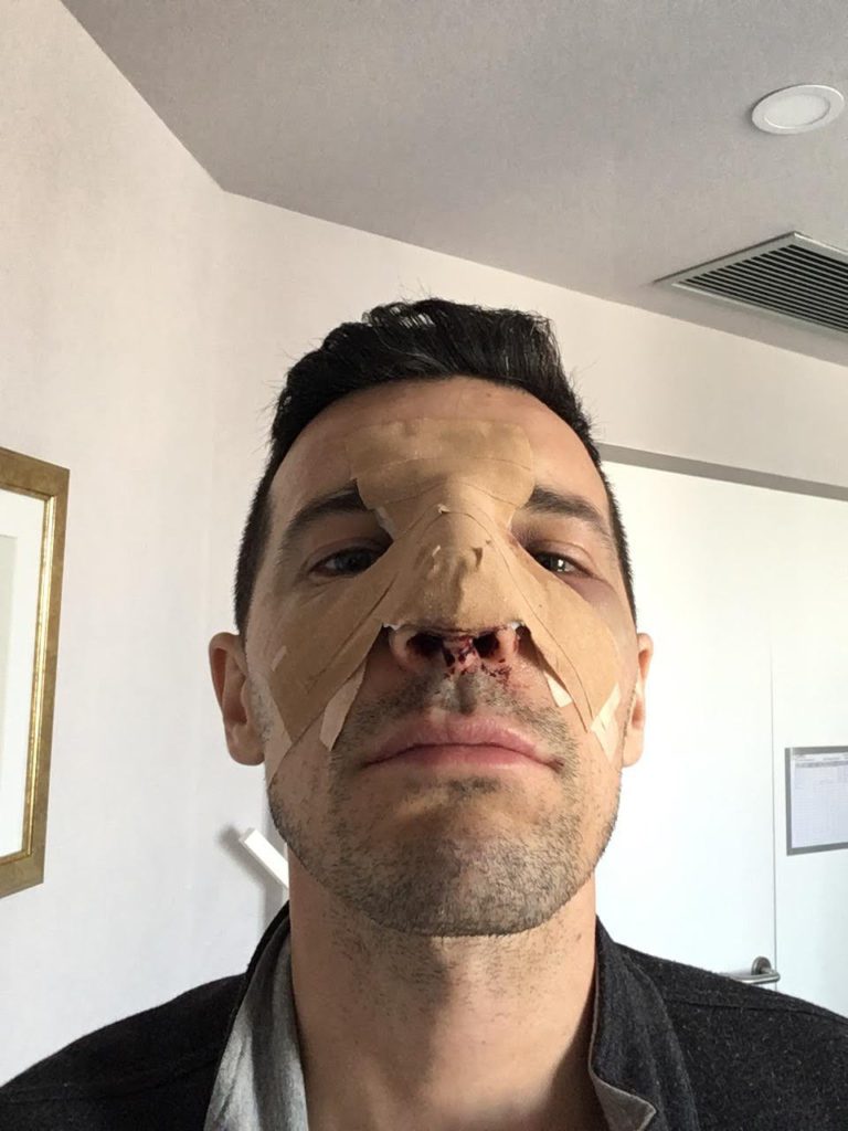 A doua zi după operație